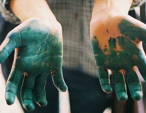 Чем оттереть зеленку с кожи рук