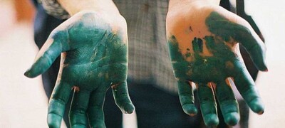 Чем оттереть зеленку с кожи рук